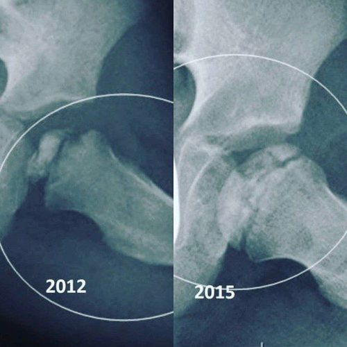 B-Luron: Neverjetna rešitev za vaše sklepe!